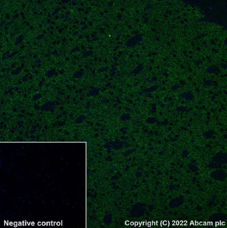 Immunohistochemistry (Formalin/PFA-fixed paraffin-embedded sections) - Alexa Fluor® 488 Anti-Tyrosine Hydroxylase antibody [EP1532Y] - Neuronal Marker (AB302827), expandable thumbnail