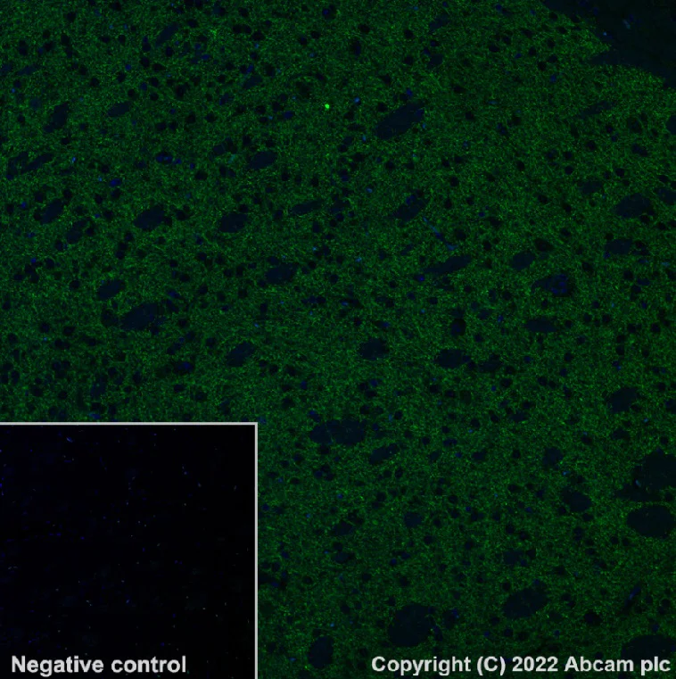 Immunohistochemistry (Formalin/PFA-fixed paraffin-embedded sections) - Alexa Fluor® 488 Anti-Tyrosine Hydroxylase antibody [EP1532Y] - Neuronal Marker (AB302827)