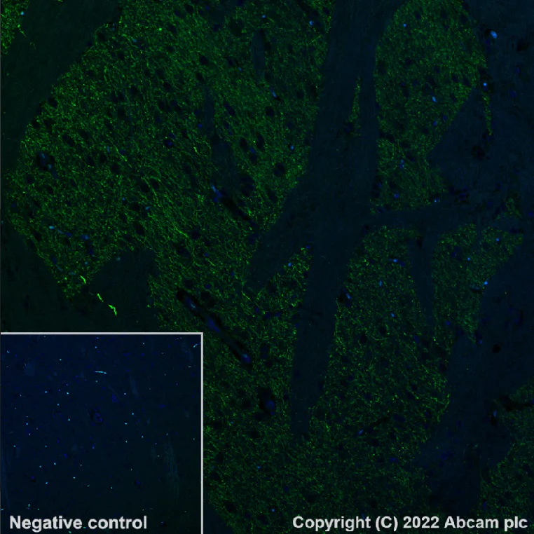 Immunohistochemistry (Formalin/PFA-fixed paraffin-embedded sections) - Alexa Fluor® 488 Anti-Tyrosine Hydroxylase antibody [EP1532Y] - Neuronal Marker (AB302827)