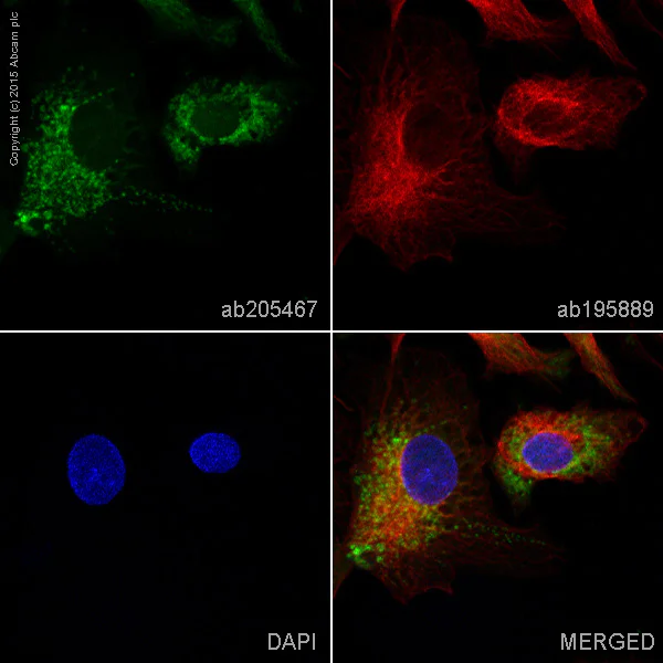 Immunocytochemistry/ Immunofluorescence - Alexa Fluor® 488 Anti-Ubiquitin antibody [EPR8830] (AB205467)