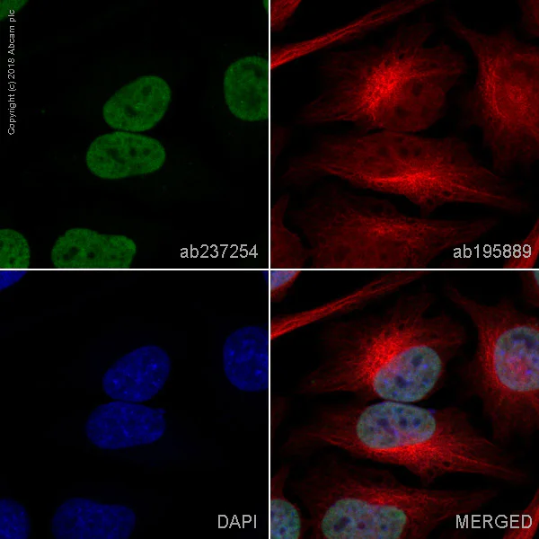Immunocytochemistry/ Immunofluorescence - Alexa Fluor® 488 Anti-Ubiquitin (linkage-specific K27) antibody [EPR17034] (AB237254)