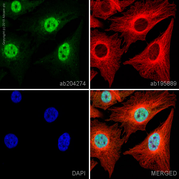 Immunocytochemistry/ Immunofluorescence - Alexa Fluor® 488 Anti-Ubiquitin (linkage-specific K48) antibody [EP8589] (AB204274), expandable thumbnail