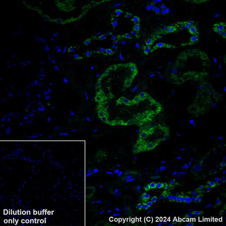 Immunohistochemistry (Formalin/PFA-fixed paraffin-embedded sections) - Alexa Fluor® 488 Anti-UQCRC2 antibody [EPR13051] (AB309702)