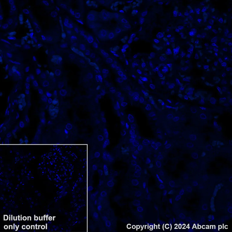 Immunohistochemistry (Formalin/PFA-fixed paraffin-embedded sections) - Alexa Fluor® 488 Anti-Uteroglobin antibody [EPR27144-86] (AB317665)