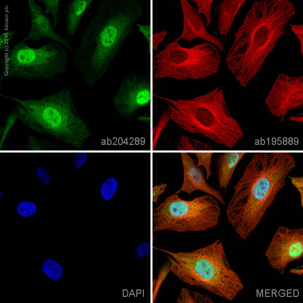 Immunocytochemistry/ Immunofluorescence - Alexa Fluor® 488 Anti-VCP antibody [EPR3307(2)] (AB204289)