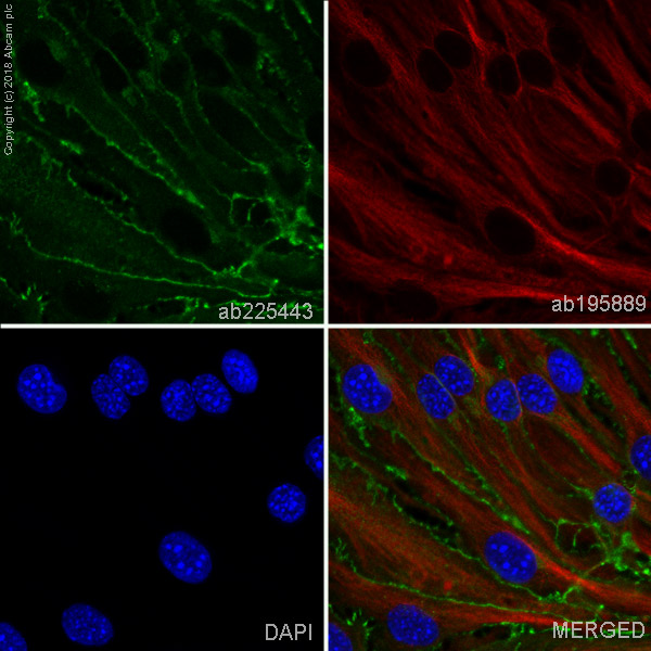 Immunocytochemistry/ Immunofluorescence - Alexa Fluor® 488 Anti-VE Cadherin antibody [EPR18229] - Intercellular Junction Marker (AB225443), expandable thumbnail