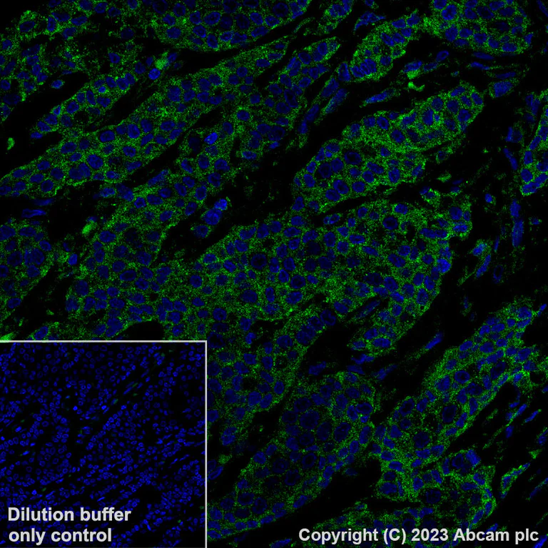 Immunohistochemistry (Formalin/PFA-fixed paraffin-embedded sections) - Alexa Fluor® 488 Anti-VEGF Receptor 1 antibody [Y103] (AB309078)
