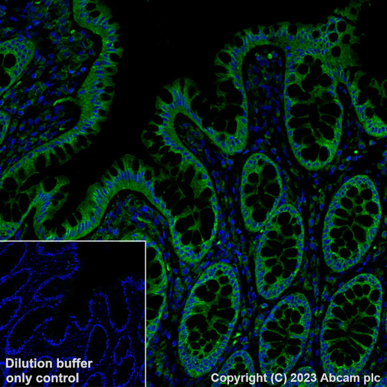 Immunohistochemistry (Formalin/PFA-fixed paraffin-embedded sections) - Alexa Fluor® 488 Anti-VEGF Receptor 1 antibody [Y103] (AB309078)