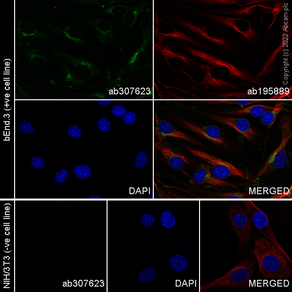 Immunocytochemistry/ Immunofluorescence - Alexa Fluor® 488 Anti-VEGF Receptor 2 antibody [EPR21884-236] (AB307623), expandable thumbnail