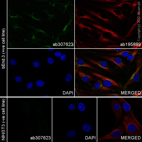 Immunocytochemistry/ Immunofluorescence - Alexa Fluor® 488 Anti-VEGF Receptor 2 antibody [EPR21884-236] (AB307623)
