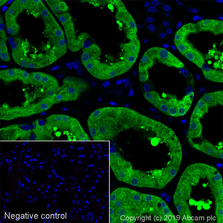 Immunohistochemistry (Formalin/PFA-fixed paraffin-embedded sections) - Alexa Fluor® 488 Anti-VEGFD antibody [EPR8457] (AB252051), expandable thumbnail