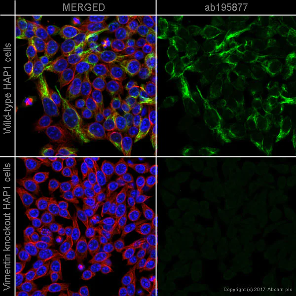 Immunocytochemistry/ Immunofluorescence - Alexa Fluor® 488 Anti-Vimentin antibody [V9] - Cytoskeleton Marker (AB195877)