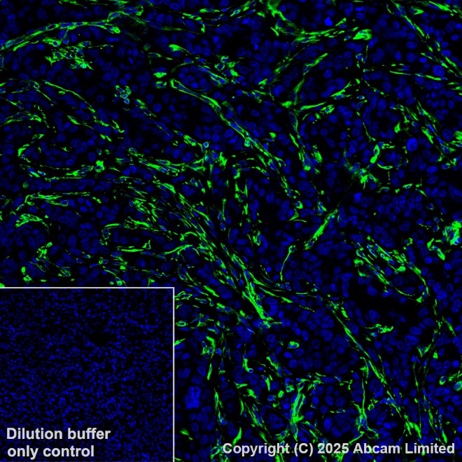 Immunohistochemistry (Formalin/PFA-fixed paraffin-embedded sections) - Alexa Fluor® 488 Anti-Vimentin antibody [V9] - Cytoskeleton Marker (AB195877)