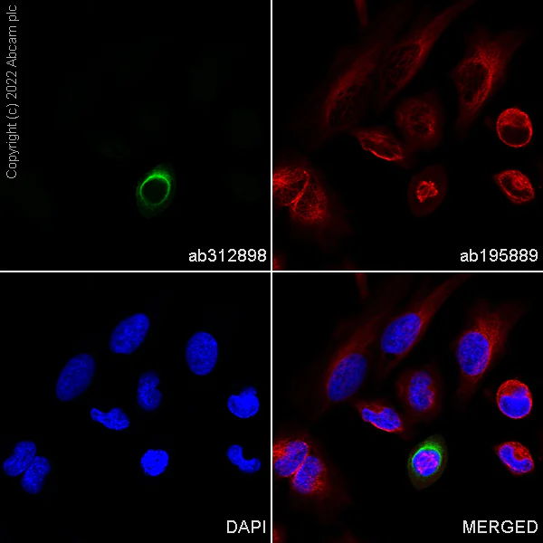 Immunocytochemistry/ Immunofluorescence - Alexa Fluor® 488 Anti-Vimentin (phospho S56) antibody [EPR21084] (AB312898)