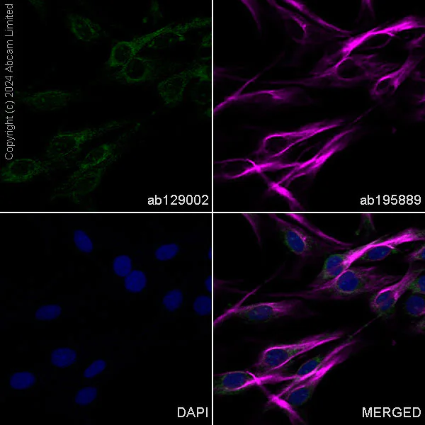 Immunocytochemistry/ Immunofluorescence - Alexa Fluor® 488 Anti-Vinculin antibody [EPR8185] (AB196454)