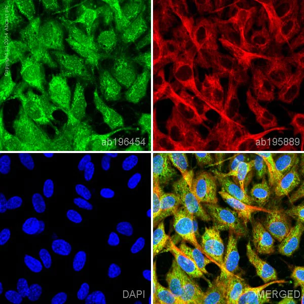 Immunocytochemistry/ Immunofluorescence - Alexa Fluor® 488 Anti-Vinculin antibody [EPR8185] (AB196454)