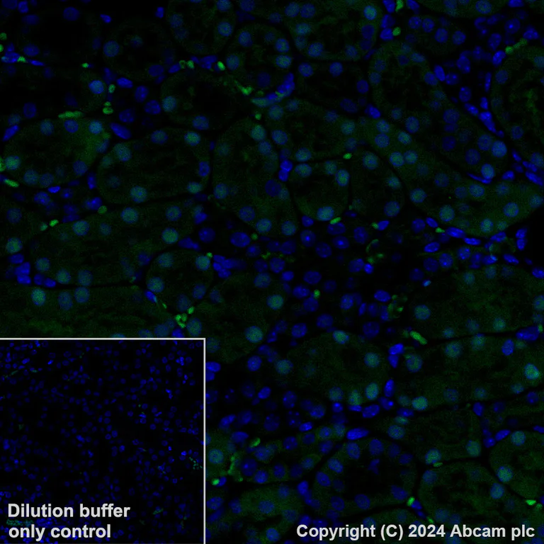 Immunohistochemistry (Formalin/PFA-fixed paraffin-embedded sections) - Alexa Fluor® 488 Anti-Visfatin antibody [EPR21980] (AB319013)