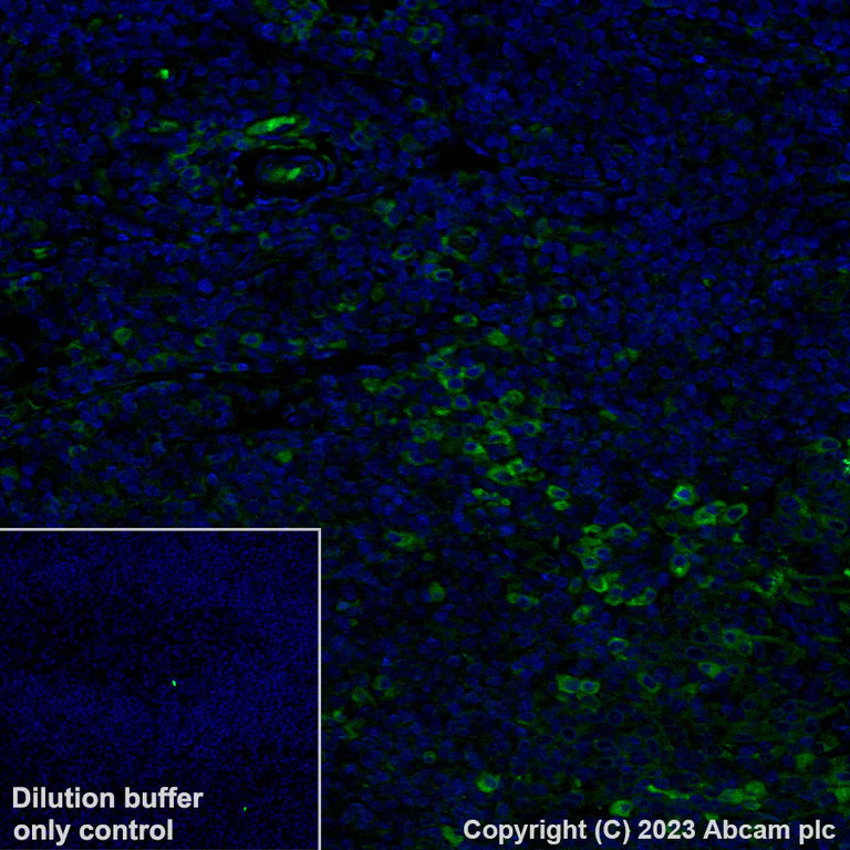 Immunohistochemistry (Formalin/PFA-fixed paraffin-embedded sections) - Alexa Fluor® 488 Anti-VISTA antibody [EPR21050] (AB314678)