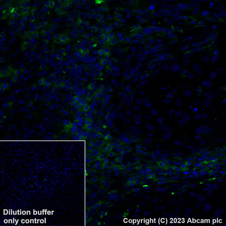 Immunohistochemistry (Formalin/PFA-fixed paraffin-embedded sections) - Alexa Fluor® 488 Anti-VISTA antibody [EPR21050] (AB314678)