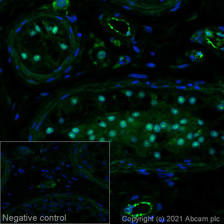 Immunohistochemistry (Formalin/PFA-fixed paraffin-embedded sections) - Alexa Fluor® 488 Anti-Wilms Tumor Protein antibody [EPR23963-116] (AB282664)