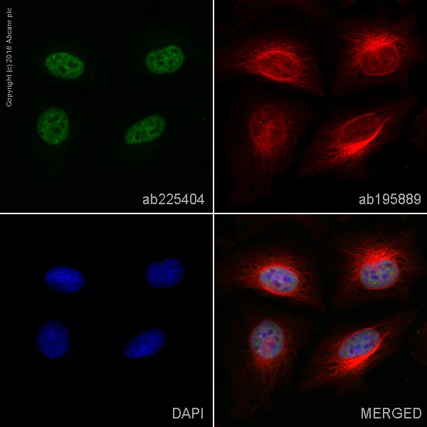 Immunocytochemistry/ Immunofluorescence - Alexa Fluor® 488 Anti-WTAP antibody [EPR18744] (AB225404)