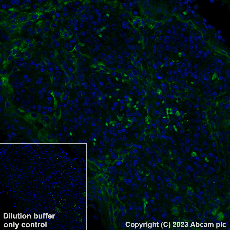 Immunohistochemistry (Formalin/PFA-fixed paraffin-embedded sections) - Alexa Fluor® 488 Anti-YKL-40/CHI3L1 antibody [EPR27396-56] (AB314164), expandable thumbnail