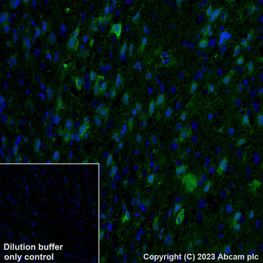 Immunohistochemistry (Formalin/PFA-fixed paraffin-embedded sections) - Alexa Fluor® 488 Anti-YKL-40/CHI3L1 antibody [EPR27396-56] (AB314164), expandable thumbnail
