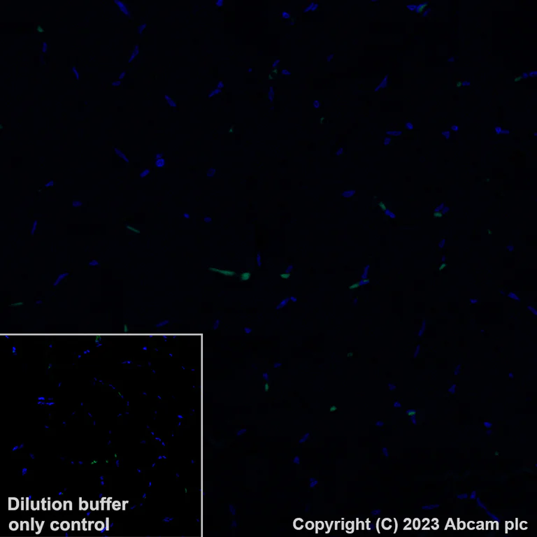 Immunohistochemistry (Formalin/PFA-fixed paraffin-embedded sections) - Alexa Fluor® 488 Anti-YKL-40/CHI3L1 antibody [EPR27396-56] (AB314164)