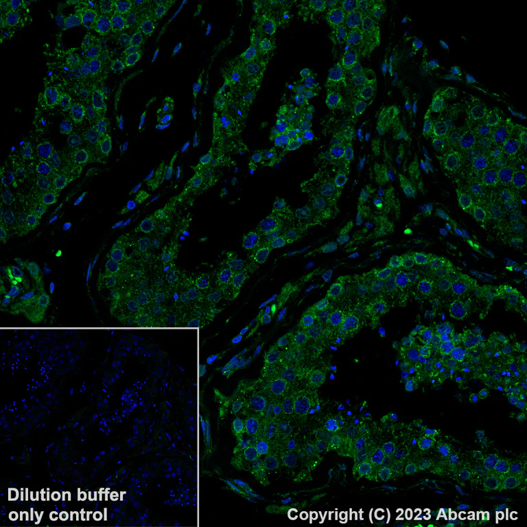 Immunohistochemistry (Formalin/PFA-fixed paraffin-embedded sections) - Alexa Fluor® 488 Anti-YTHDF2 antibody [EPR23544-19] (AB309605)