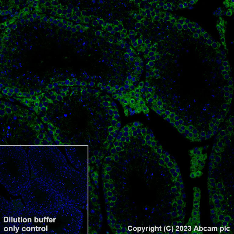 Immunohistochemistry (Formalin/PFA-fixed paraffin-embedded sections) - Alexa Fluor® 488 Anti-YTHDF2 antibody [EPR23544-19] (AB309605)