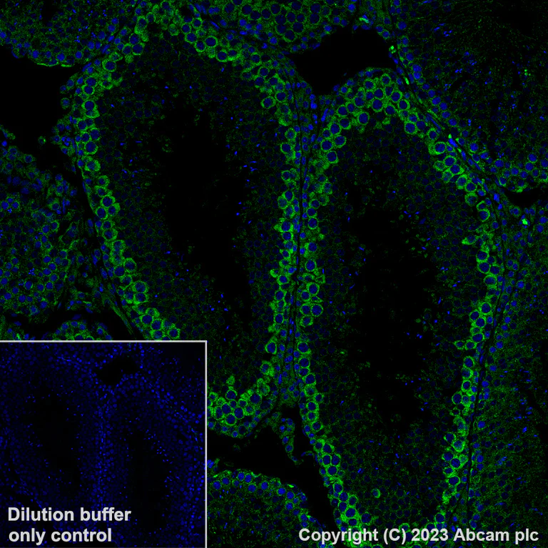 Immunohistochemistry (Formalin/PFA-fixed paraffin-embedded sections) - Alexa Fluor® 488 Anti-YTHDF2 antibody [EPR23544-19] (AB309605)