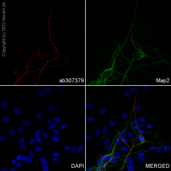 Immunocytochemistry/ Immunofluorescence - Alexa Fluor® 555 Anti-68kDa Neurofilament/NF-L antibody [EPR22035-112] (AB307379), expandable thumbnail
