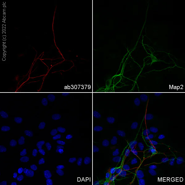 Immunocytochemistry/ Immunofluorescence - Alexa Fluor® 555 Anti-68kDa Neurofilament/NF-L antibody [EPR22035-112] (AB307379)