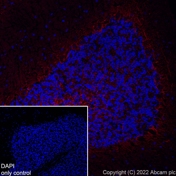 Immunohistochemistry (Frozen sections) - Alexa Fluor® 555 Anti-68kDa Neurofilament/NF-L antibody [EPR22035-112] (AB307379), expandable thumbnail