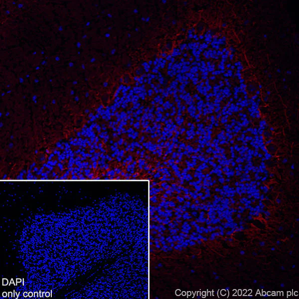 Immunohistochemistry (Frozen sections) - Alexa Fluor® 555 Anti-68kDa Neurofilament/NF-L antibody [EPR22035-112] (AB307379)