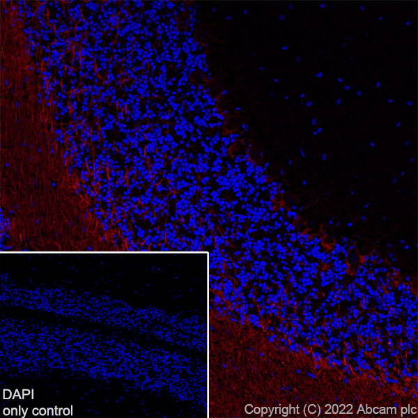 Immunohistochemistry (Frozen sections) - Alexa Fluor® 555 Anti-68kDa Neurofilament/NF-L antibody [EPR22035-112] (AB307379), expandable thumbnail