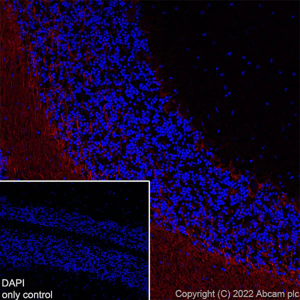 Immunohistochemistry (Frozen sections) - Alexa Fluor® 555 Anti-68kDa Neurofilament/NF-L antibody [EPR22035-112] (AB307379)