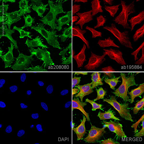 Immunocytochemistry/ Immunofluorescence - Alexa Fluor® 555 Anti-Actin antibody [EPR16769] - Cytoskeleton Marker (AB208080)