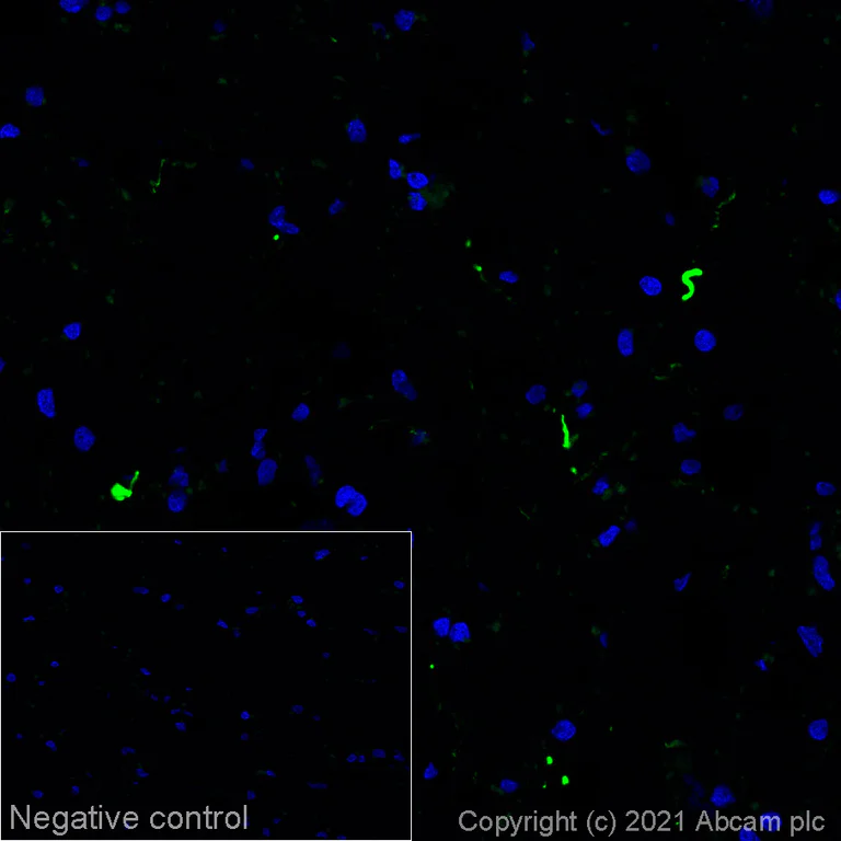 Immunohistochemistry (Frozen sections) - Alexa Fluor® 555 Anti-Alpha-synuclein aggregate antibody [MJFR-14-6-4-2] (AB283737)