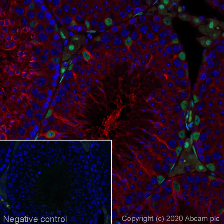 Immunohistochemistry (Formalin/PFA-fixed paraffin-embedded sections) - Alexa Fluor® 555 Anti-Androgen Receptor antibody [EPR1535(2)] (AB275124)