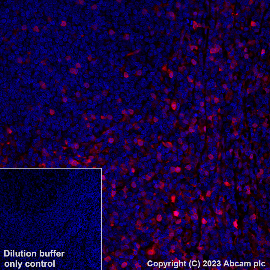 Immunohistochemistry (Formalin/PFA-fixed paraffin-embedded sections) - Alexa Fluor® 555 Anti-Annexin A1/ANXA1 antibody [EPR19342] (AB313664), expandable thumbnail
