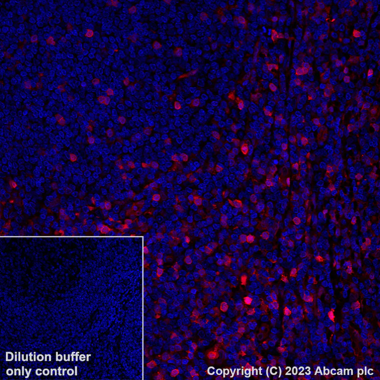 Immunohistochemistry (Formalin/PFA-fixed paraffin-embedded sections) - Alexa Fluor® 555 Anti-Annexin A1/ANXA1 antibody [EPR19342] (AB313664)