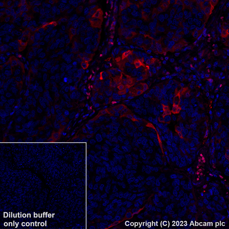Immunohistochemistry (Formalin/PFA-fixed paraffin-embedded sections) - Alexa Fluor® 555 Anti-Annexin A1/ANXA1 antibody [EPR19342] (AB313664), expandable thumbnail