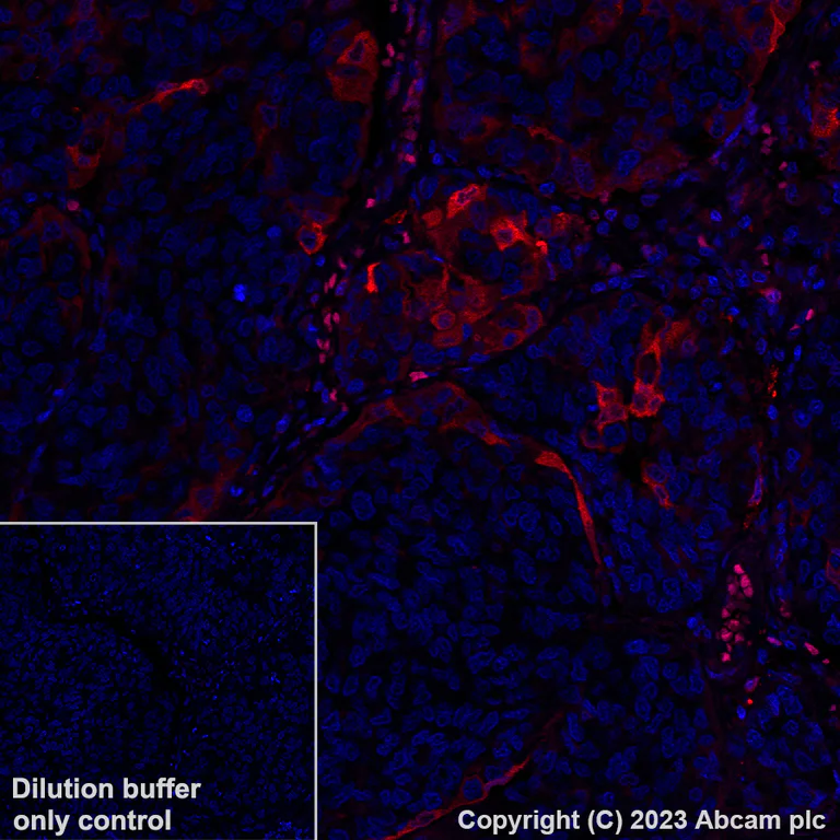 Immunohistochemistry (Formalin/PFA-fixed paraffin-embedded sections) - Alexa Fluor® 555 Anti-Annexin A1/ANXA1 antibody [EPR19342] (AB313664)