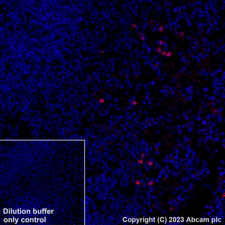 Immunohistochemistry (Formalin/PFA-fixed paraffin-embedded sections) - Alexa Fluor® 555 Anti-Annexin A1/ANXA1 antibody [EPR19342] (AB313664), expandable thumbnail