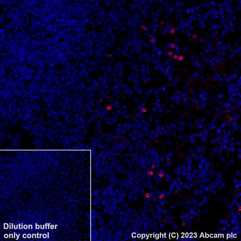 Immunohistochemistry (Formalin/PFA-fixed paraffin-embedded sections) - Alexa Fluor® 555 Anti-Annexin A1/ANXA1 antibody [EPR19342] (AB313664)