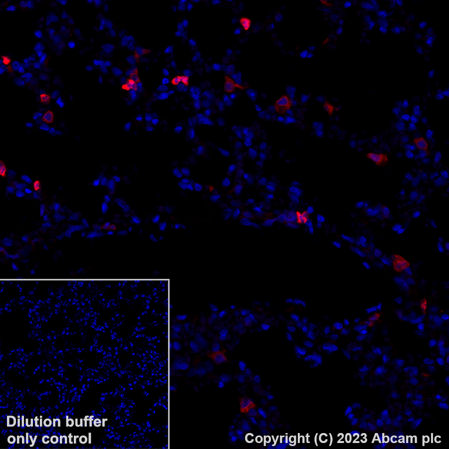 Immunohistochemistry (Formalin/PFA-fixed paraffin-embedded sections) - Alexa Fluor® 555 Anti-Annexin A1/ANXA1 antibody [EPR19342] (AB313664), expandable thumbnail