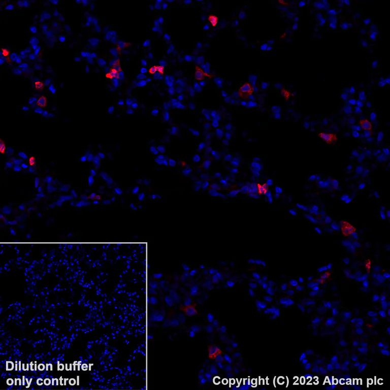 Immunohistochemistry (Formalin/PFA-fixed paraffin-embedded sections) - Alexa Fluor® 555 Anti-Annexin A1/ANXA1 antibody [EPR19342] (AB313664)