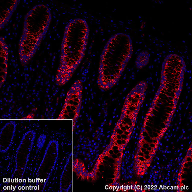 Immunohistochemistry (Formalin/PFA-fixed paraffin-embedded sections) - Alexa Fluor® 555 Anti-Aquaporin 5 antibody [EPR3747] (AB307863)