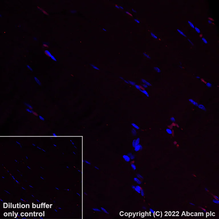 Immunohistochemistry (Formalin/PFA-fixed paraffin-embedded sections) - Alexa Fluor® 555 Anti-Aquaporin 5 antibody [EPR3747] (AB307863)
